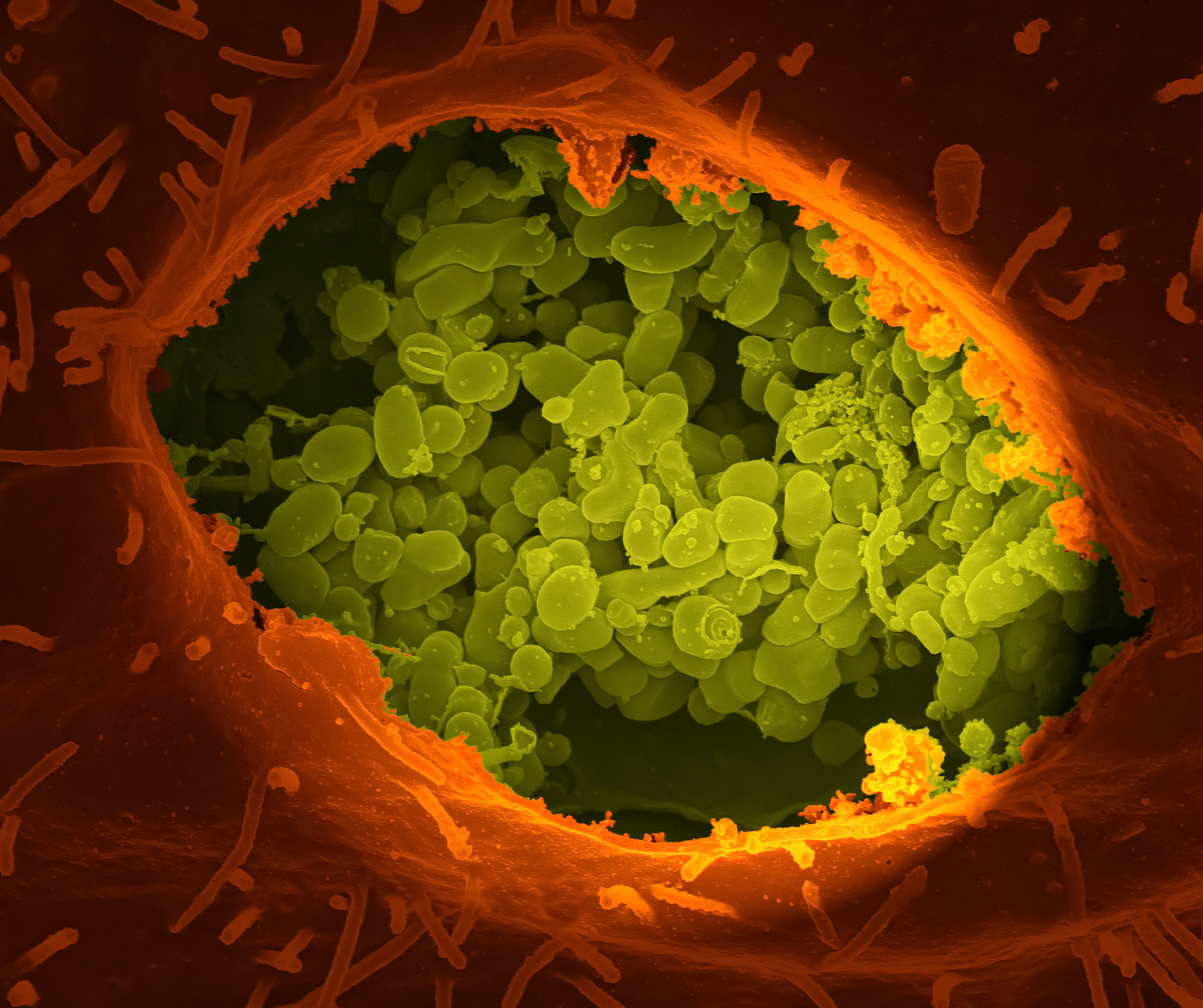 Best gut healing supplements