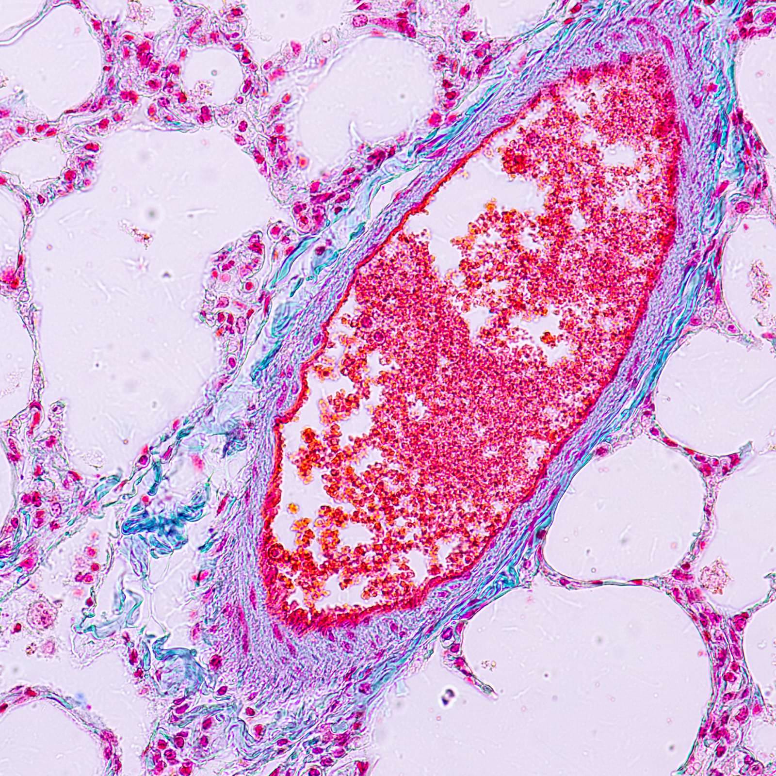 Bacteria