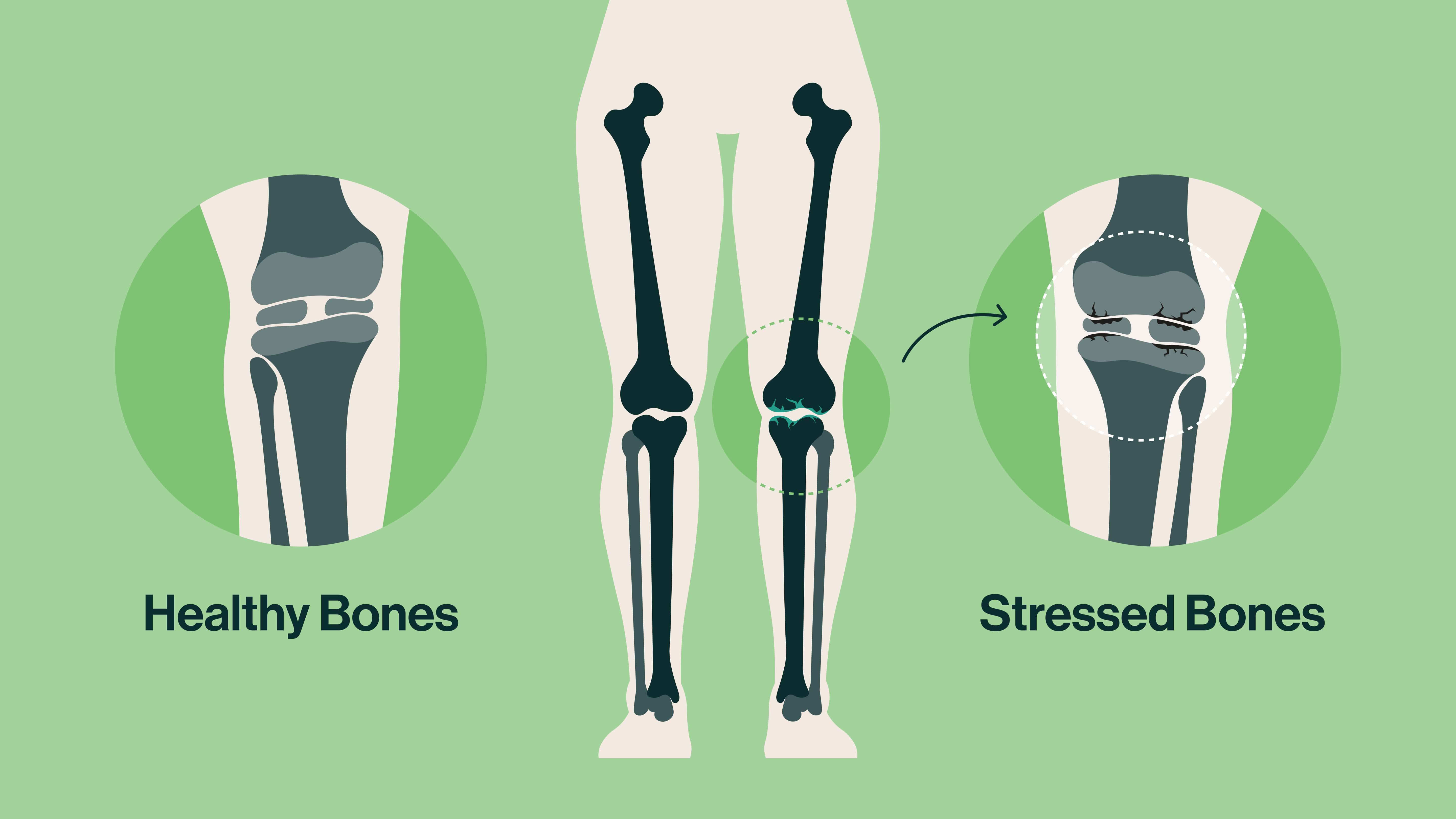 How it works: Modern life takes a toll on our joints, from long hours sitting at a desk to repetitive movements and past injuries. On top of that, bone density naturally starts declining in our 30s.